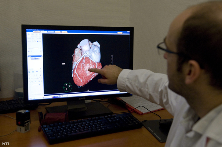 Egy szív háromdimenziós képét mutatja egy orvos számítógépe monitorán a fővárosi Városmajori Szív- és Érgyógyászati Klinikán 2013. január 11-én.