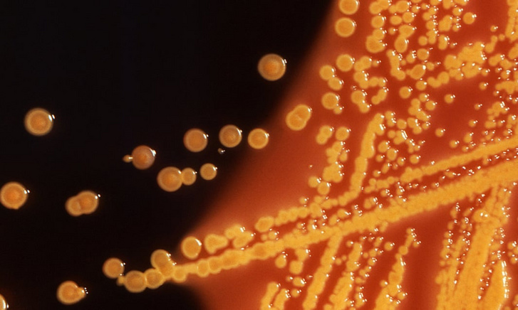 A mesterséges baktérium telepei a táptalajon