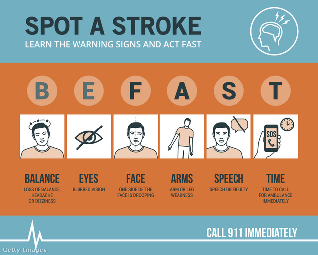 A TIA és a stroke gyakori tünetei