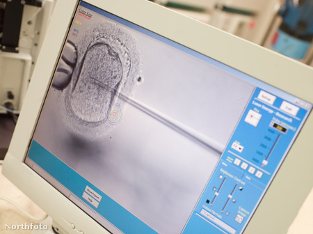 Spermiumok petesejtbe injektálása egy termékenységi klinikán