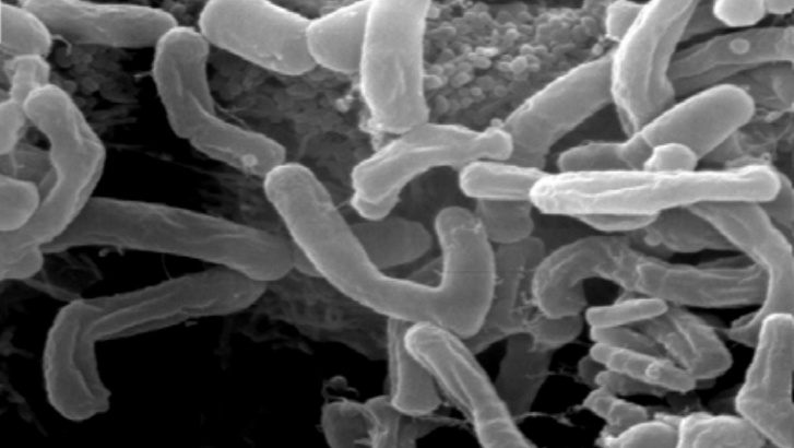 Bifidobacterium longum sejtek