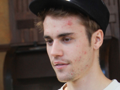 Így néz ki Justin Bieber smink/retus nélkül