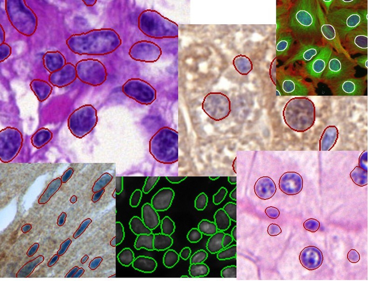 Az algoritmus által azonosított és kijelölt sejtek különféle szövetekben