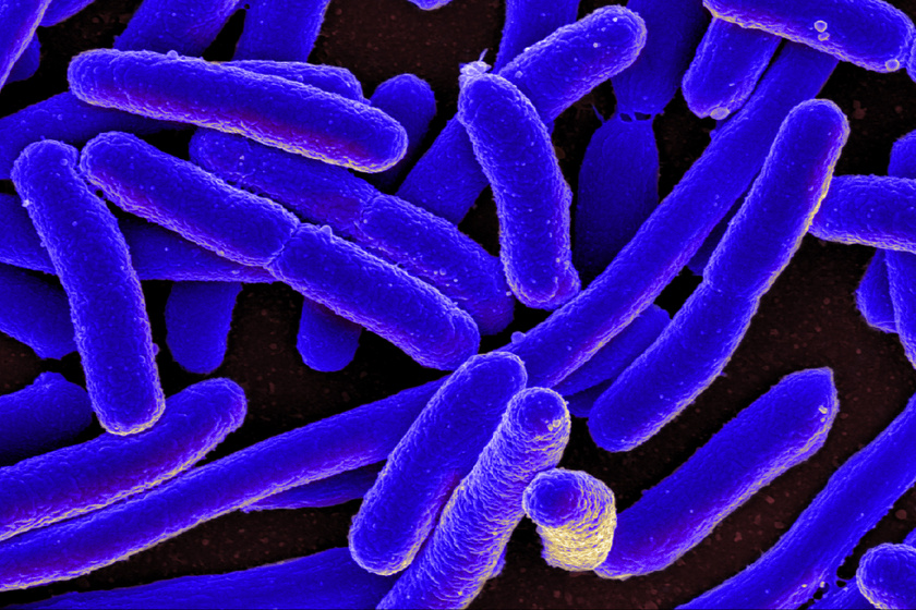 e coli bacteria 16578744517 wikiedited