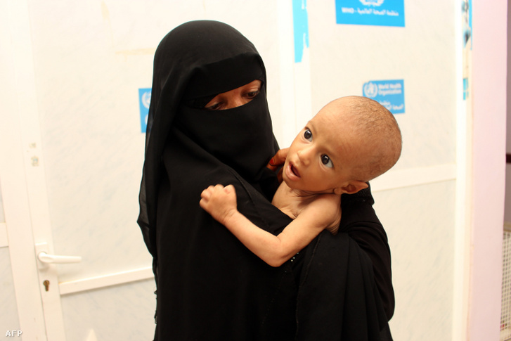 7 hónapos alultáplált csecsemőt tart kezében egy jemeni anya, akit a konfliktus által súlytott Hajjah városában található kórházba vitt be ellenőrzésre 2019. június 19-én