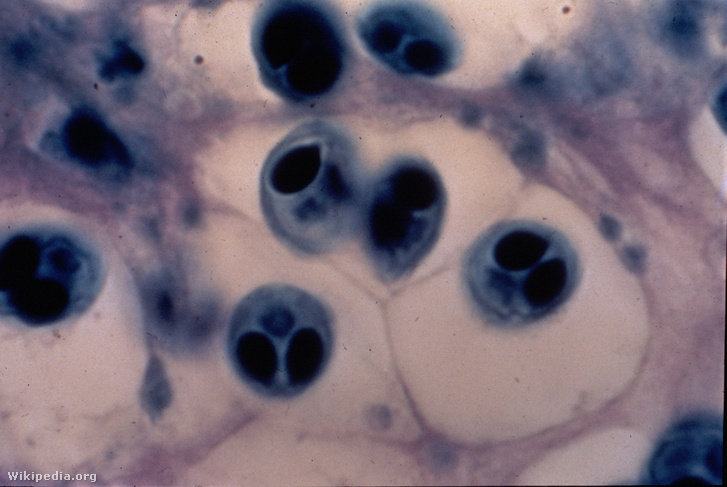 Myxobolus cerebralis myxospórák pisztráng porcszövet metszetében