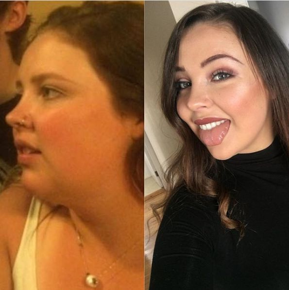 Ilyen az arc 50 kiló fogyás után: megdöbbentőek az előtte-utána képek - Fogyókúra | Femina