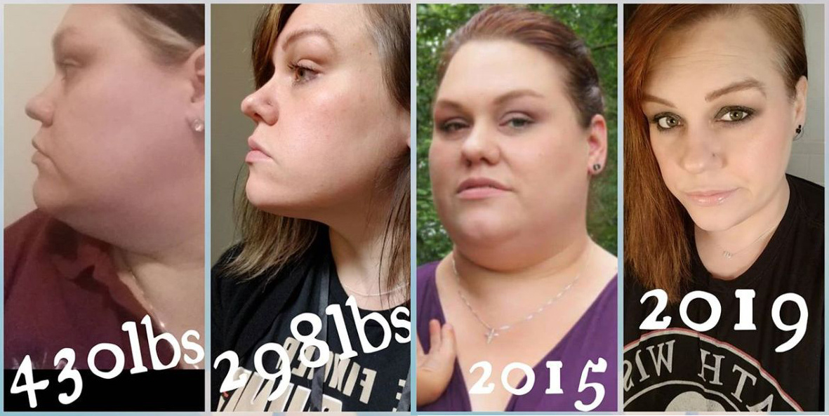 Pár fogyás előtt és után, -87 kg 6 hónap alatt!