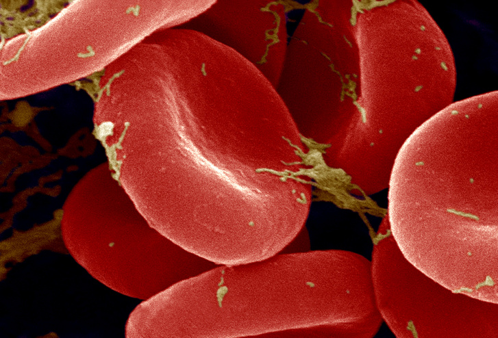 Vörösvérsejtek egy elektronmikroszkópos felvételen