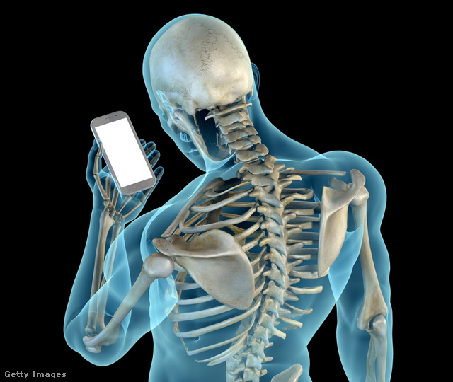 A nyaki gerinc nekrovertebrális artrózisa hogyan kell kezelni az Osteoarthritis kezelését