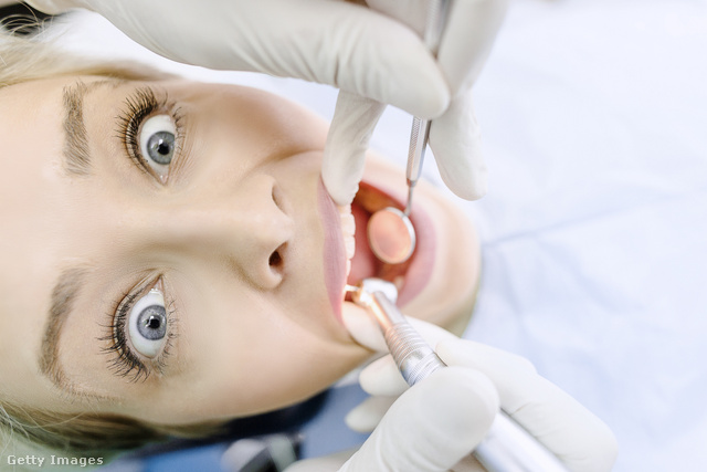 A legtöbben hajlamosak vagyunk túlparázni a fogorvosi látogatást – teljesen fölöslegesen
