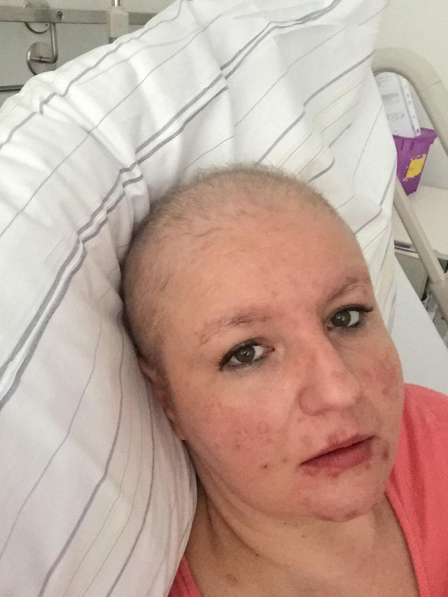 Marcsi a mellműtét előtt