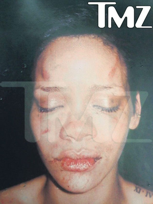 Rihanna összevert arca a TMZ által kiszivárogtatott rendőrségi fotón