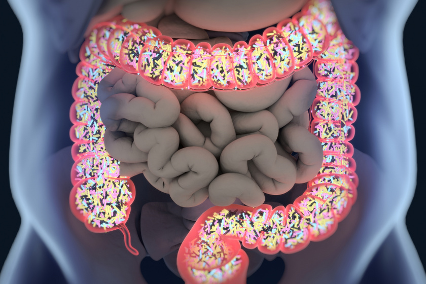 5 ok, amiért fogyassz probiotikumokat, Jó bél egészség a fogyáshoz