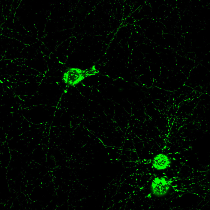 Élő idegsejtek, floreszcensen festett mitokondriumokkal