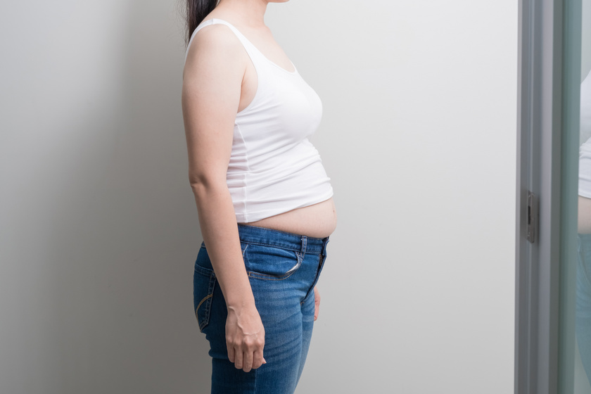 Bőr alatti zsírvesztés előtt és után