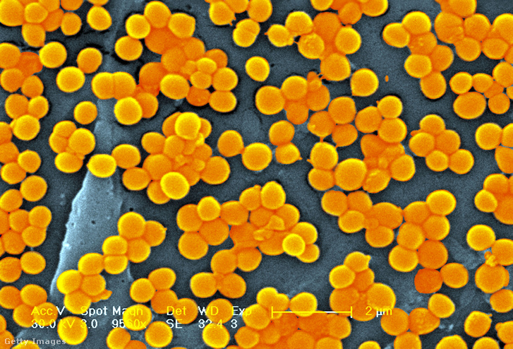 Staphylococcus aureus baktérium. Egészséges emberek bőrén, orrnyálkahártyáján, de székletében is megtalálható.