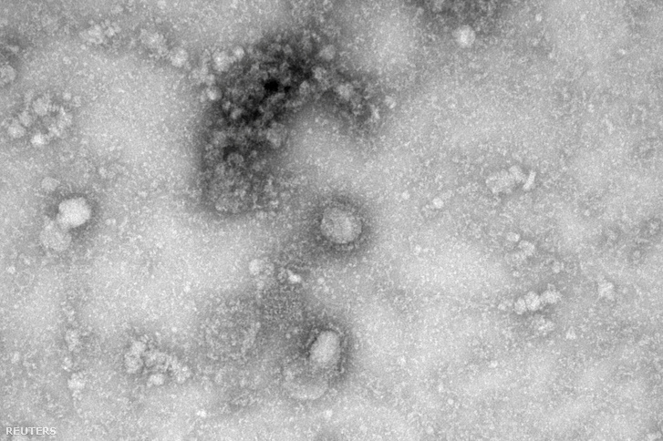 Első izolált koronavírus transzmissziós elektromikroszkópos képe