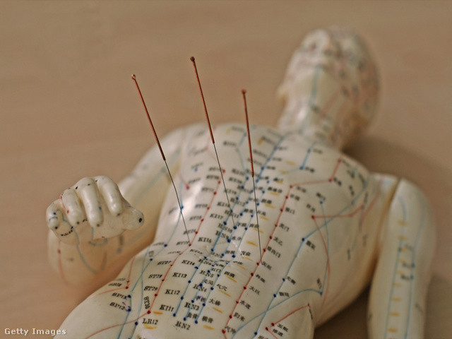 A kínai meridiánok rendszere az akupunktúra alapját képezi