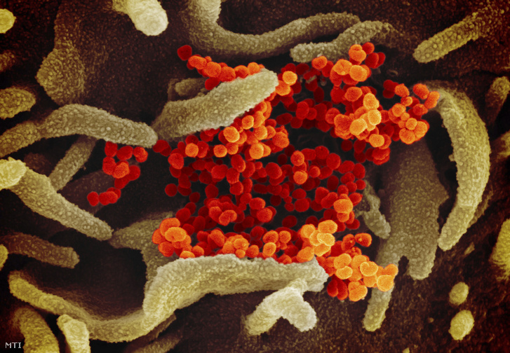 Az amerikai Allergiás és Fertõzõ Betegségek Országos Intézete (NIAID) által közreadott keltezetlen elektronmikroszkópos felvétel a tüdőgyulladást okozó új koronavírusról, amint a laboratóriumban tenyésztett narancssárga színű kórokozó előtör a környező sejtből.