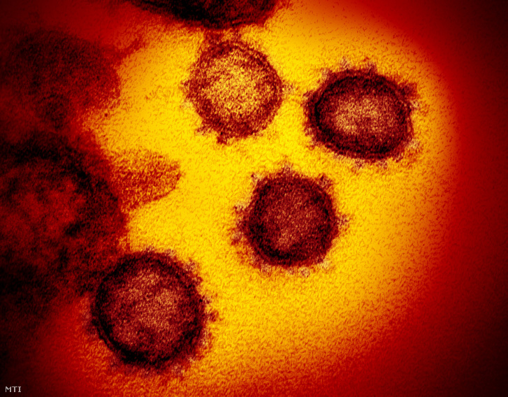 Az amerikai Allergiás és Fertőző Betegségek Országos Intézete (NIAID) által közreadott elektronmikroszkópos kép a koronavírusról.