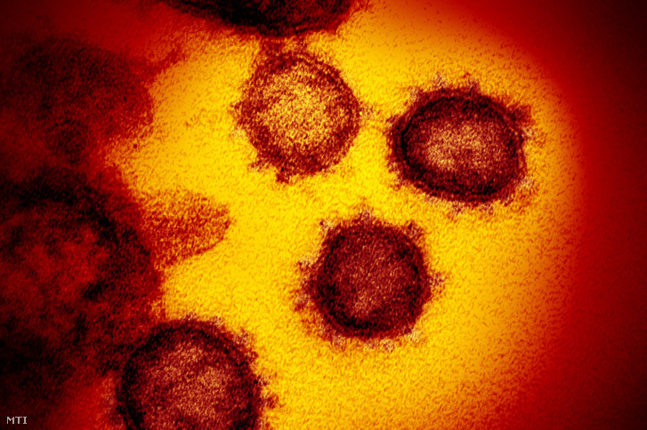 Elektronmikroszkópos kép a SARS-CoV-2 nevű koronavírusról, új néven COVID-19