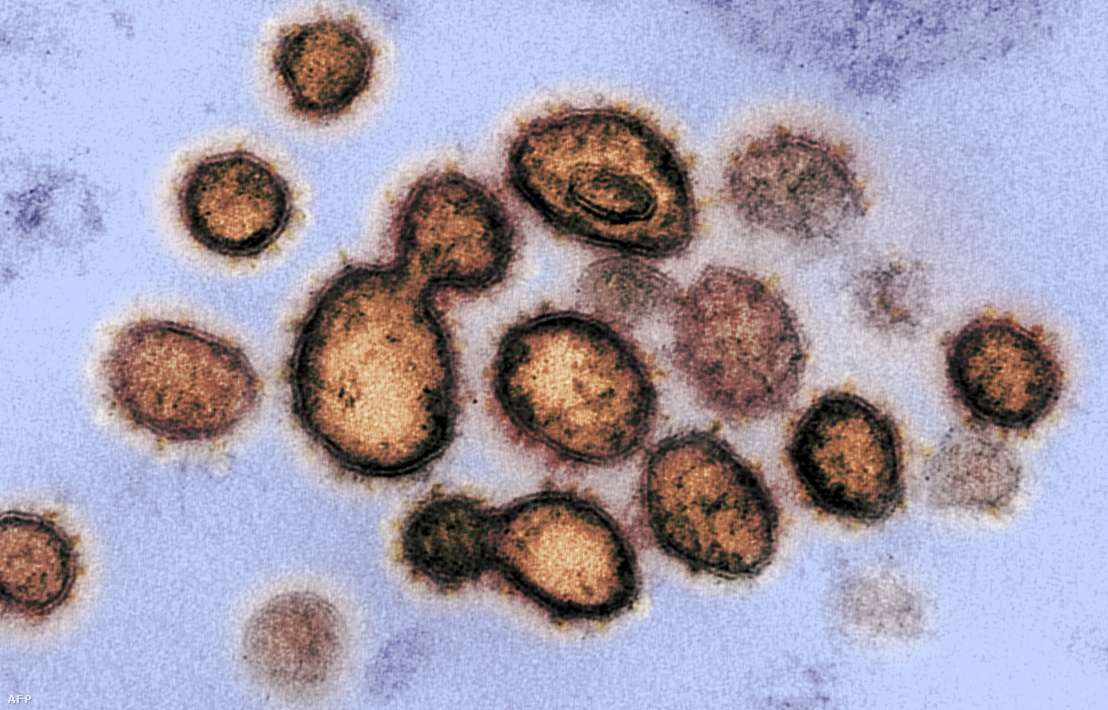 SARS-CoV-2, azaz a COVID-19 izolált koronavírus elektromikroszkópikus képe