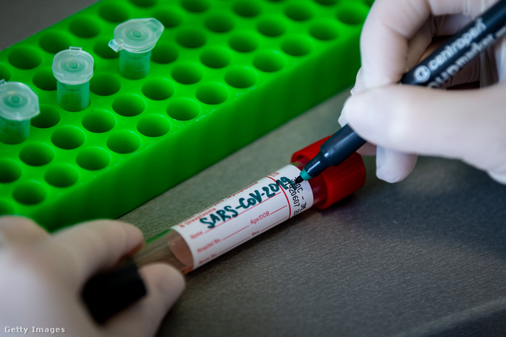 Koronavírus-teszt az első erre alkalmas csehországi magánlaborban 2020. március 18-án.