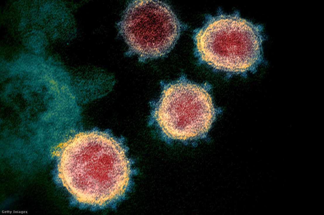 Betegből izolált Covid-19 vírus képe