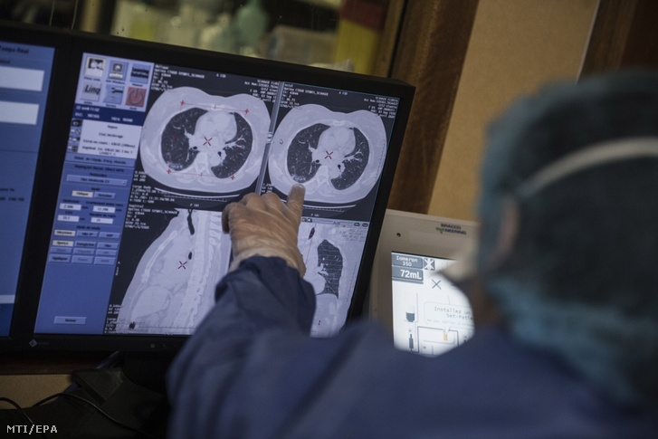 Fertőzés gyanújával kórházba került beteg röntgenképét nézi egy egészségügyi dolgozó a Párizs melletti Bagnolet Floral Klinikájának elkülönítőjében 2020. április 22-én.