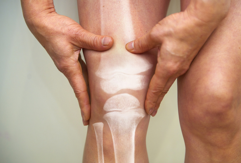 a térdízület első fokú artrózisa gyógynövények összetétele ízületi fájdalmak kezelésére