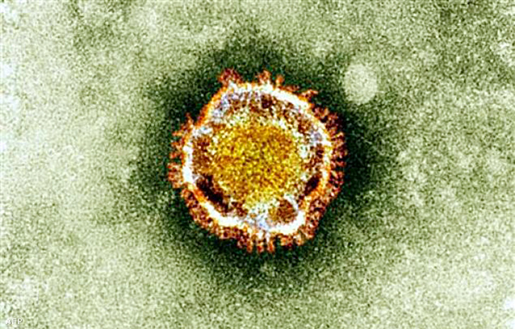 Az új koronavírus elektronmikroszkópos képe