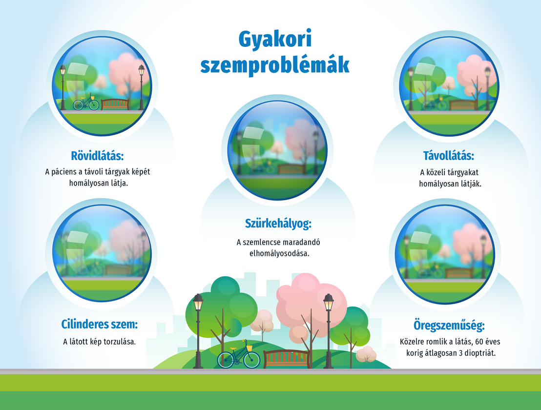 Mi az a keratokónusz? | CooperVision Hungary