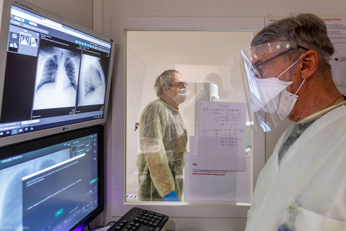 Koronavírusos beteg tüdőröntgenjét vizsgálja egy orvos egy belga kórházban 2020 áprilisában.