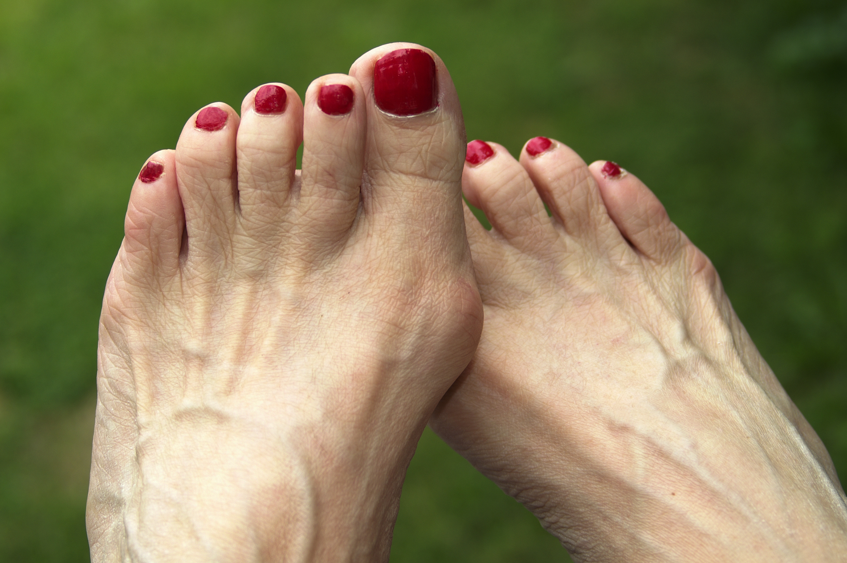 Kis lábujj ízületi fájdalma, Milyen betegségekről árulkodik a láb? - HáziPatika