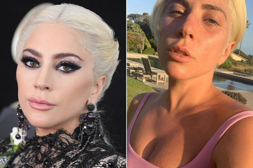 Lady Gaga új, smink nélküli szelfijét agyondicsérték a rajongók.