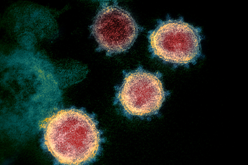 A képen az új koronavírus, a SARS-CoV-2 látható, amit egy, a COVID-19-vel fertőzött amerikai személyből izoláltak.