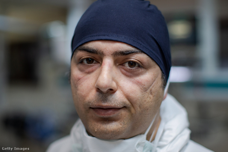 Egy koronavírus-járvány fertőző osztályán dolgozó orvos, Sakir Hana Aksu arcmaszk használata után Törökországban, Ankarában 2020. április 10-én