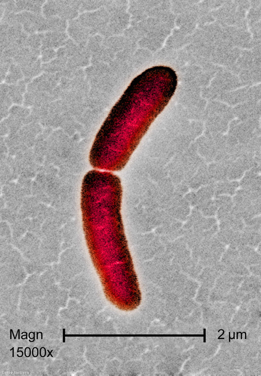 Salmonella typhimurium baktérium.