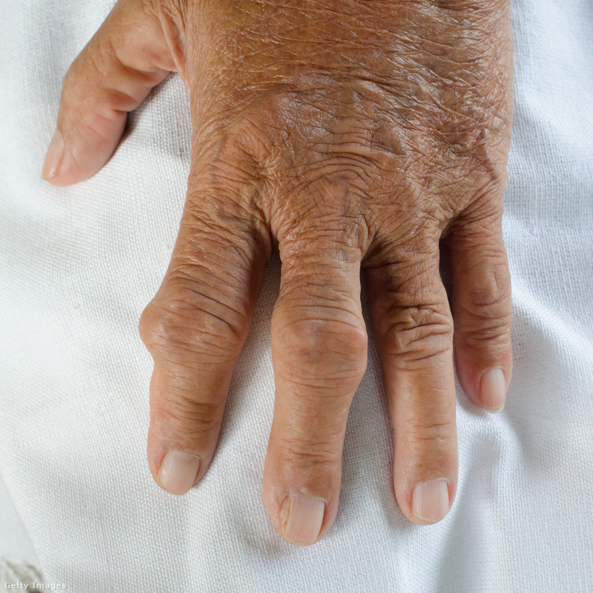fájdalom a kezek és a lábak ízületeiben este izomfájdalom csípőízületi gyulladással