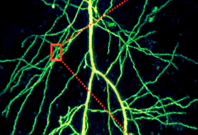 Fluoreszcens festékkel feltöltött idegsejt dendritjei