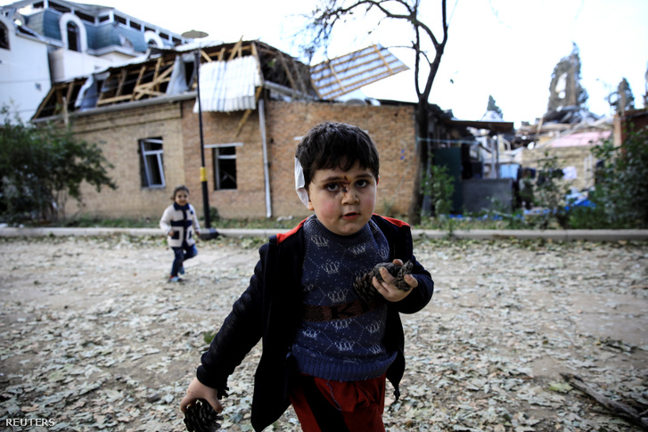 Egy robbanás során megsérült 5 éves kisfiú, Bahtijar Elnur játszik testvérével Gandzsa városában 2020. október 11-én