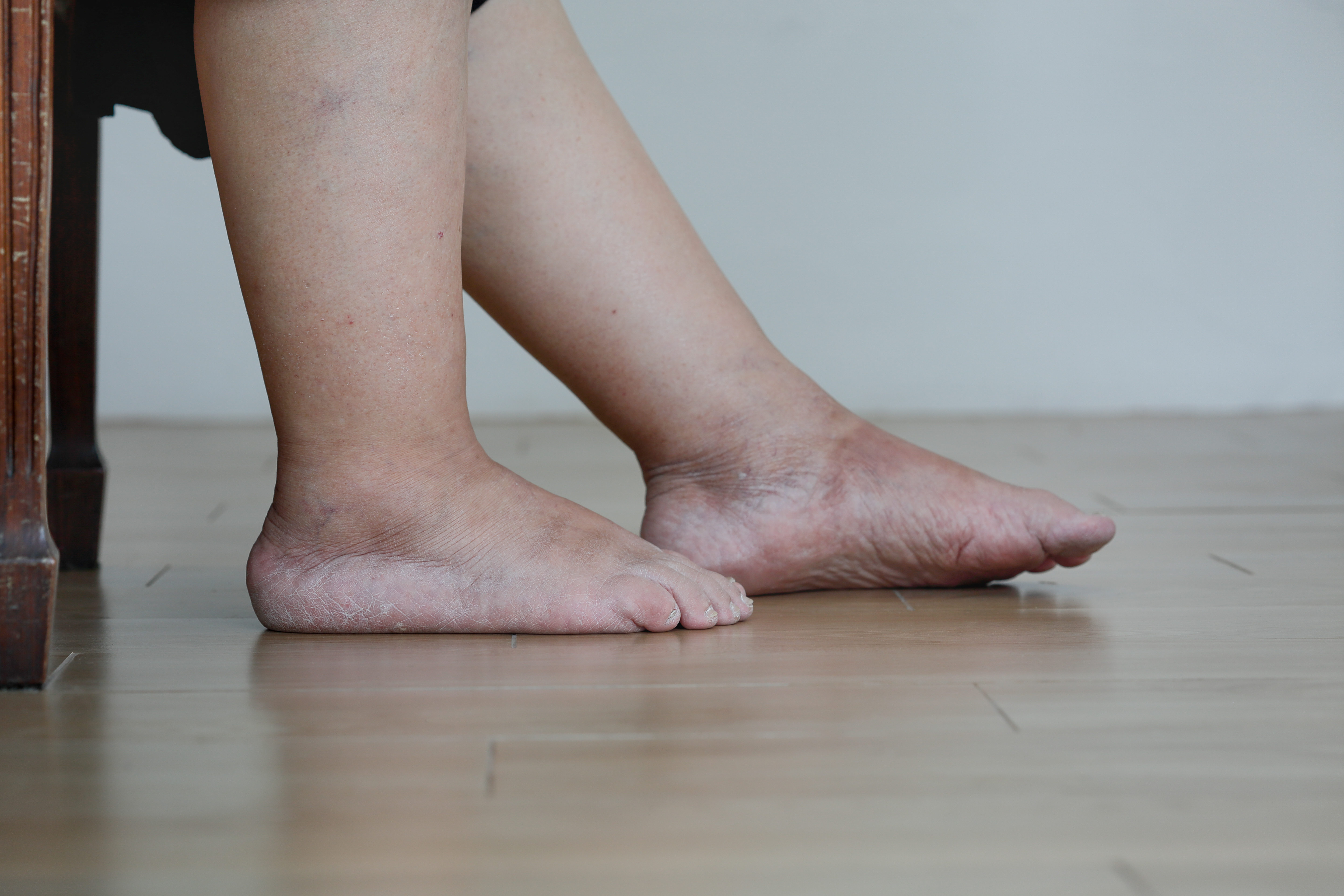 vándorló fájdalmak a csípőízületekben artrózis boka tünet