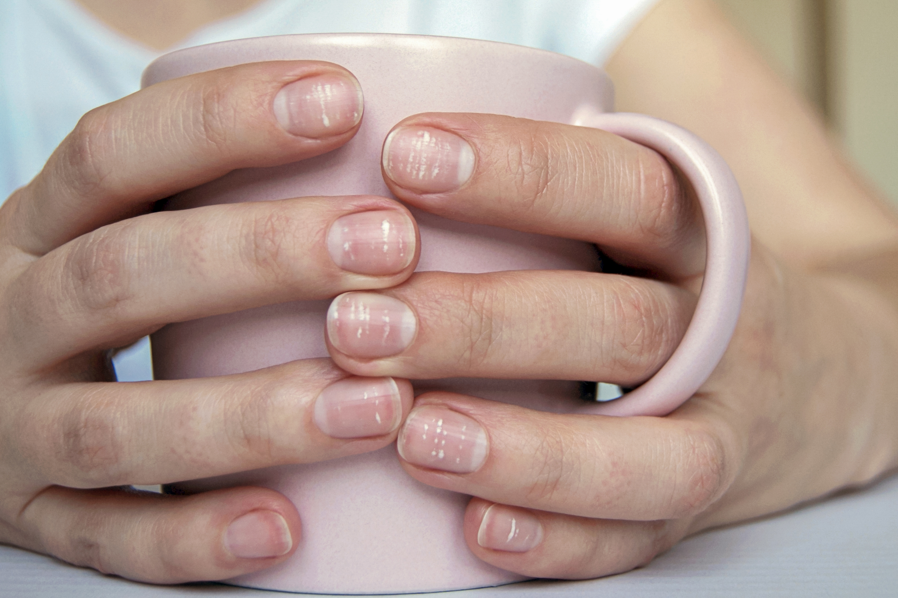 Gomba az ujjak között - hatékony kezelés fényképpel