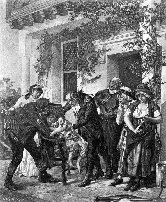 Edward Jenner beadja az első himlő elleni oltást (19. századi illusztráció).