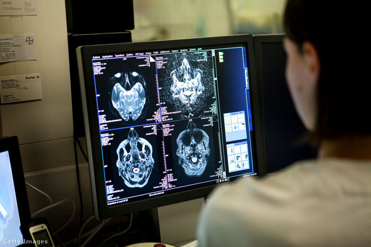 MRI-vizsgálat Franciaországban