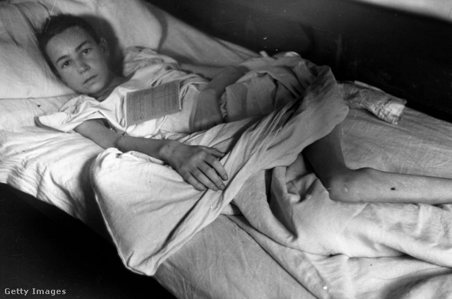 A bergen-belseni lágerből felszabadított gyermek a kórházban