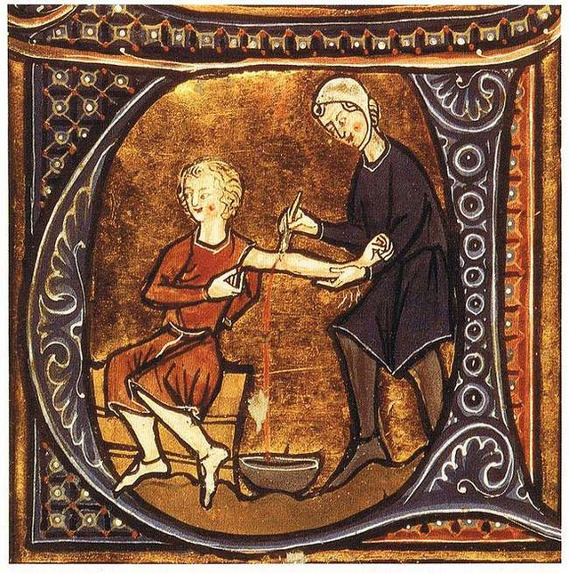 Érvágás a középkorban.