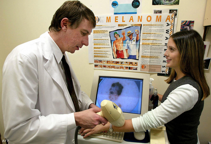 Melanomavizsgálaton vesz részt egy beteg 2003. június 23-án