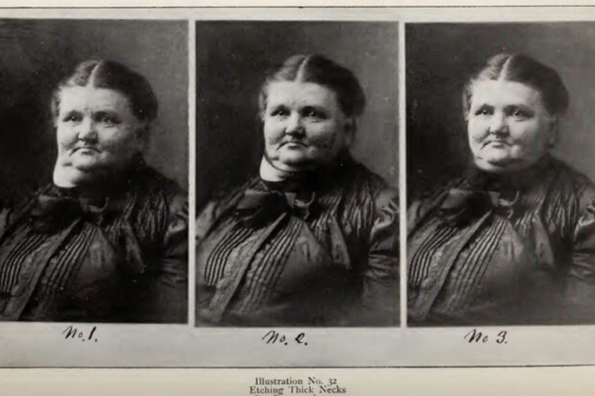 A vékonyabb nyak már a XX. század elején is teljesíthető kívánság volt a fotókon.